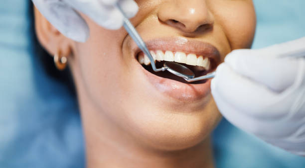 Best Urgent Care for Lost Fillings or Crowns in Cornwall, PA